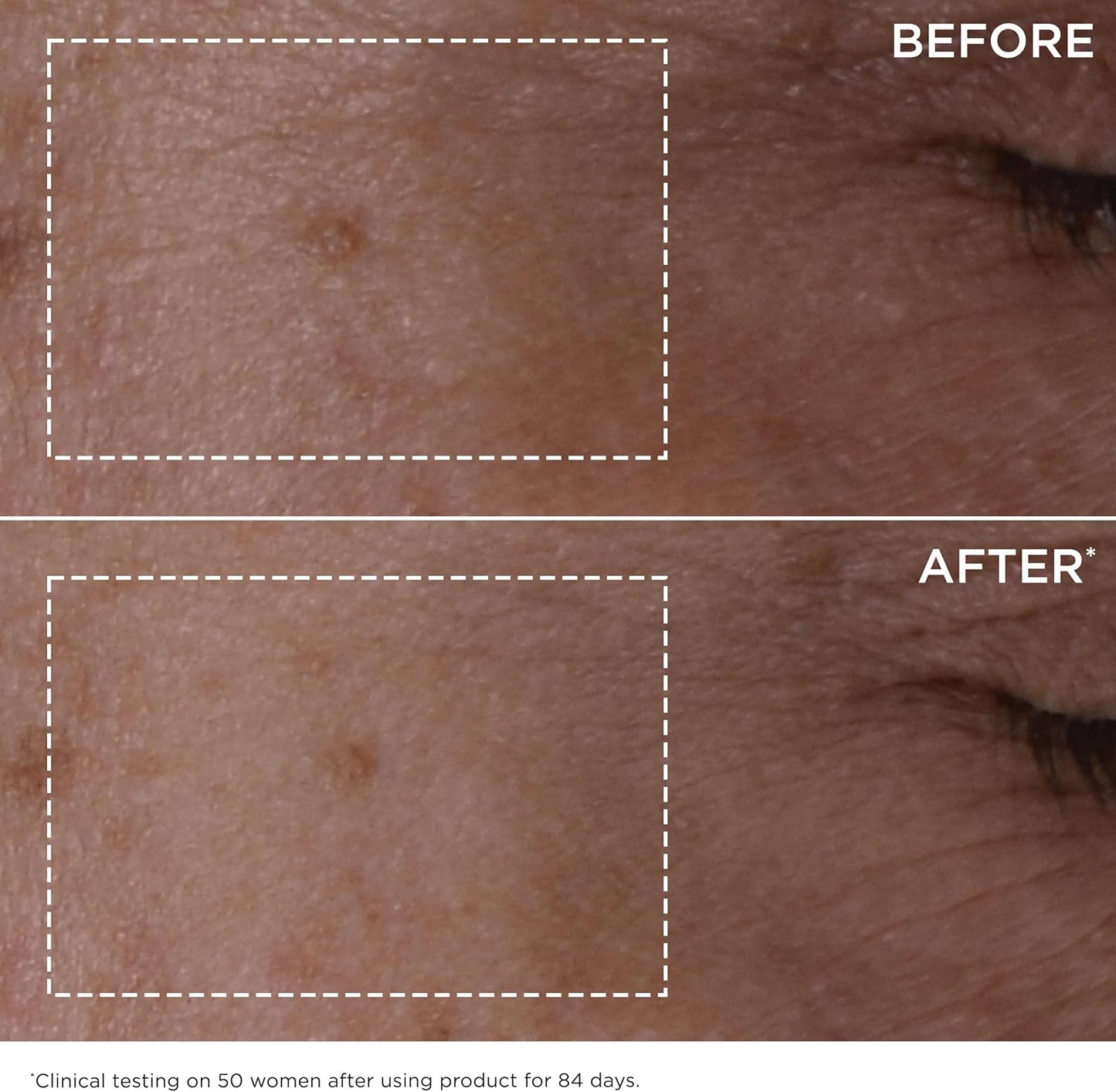 Double Serum | anti Aging Face Serum | 24H Hydration 