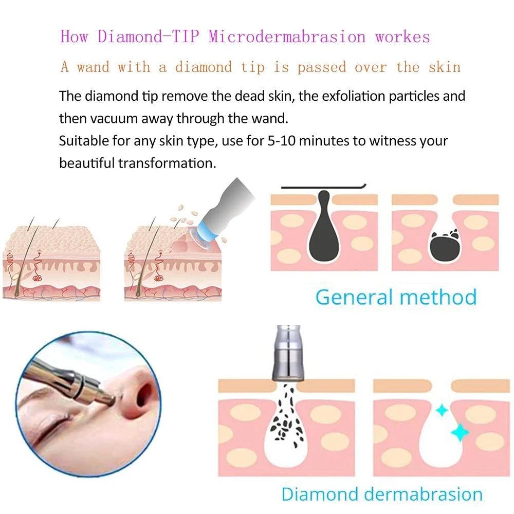 Microdermabrasion Facial Diamond Dermabrasion Machine Portable Blackhead Acne Pore Cleaning Beauty Device Rejuvenation Peeling