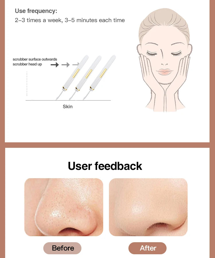 Ultrasonic Skin Scrubber Vibration Facial Lifting skin care