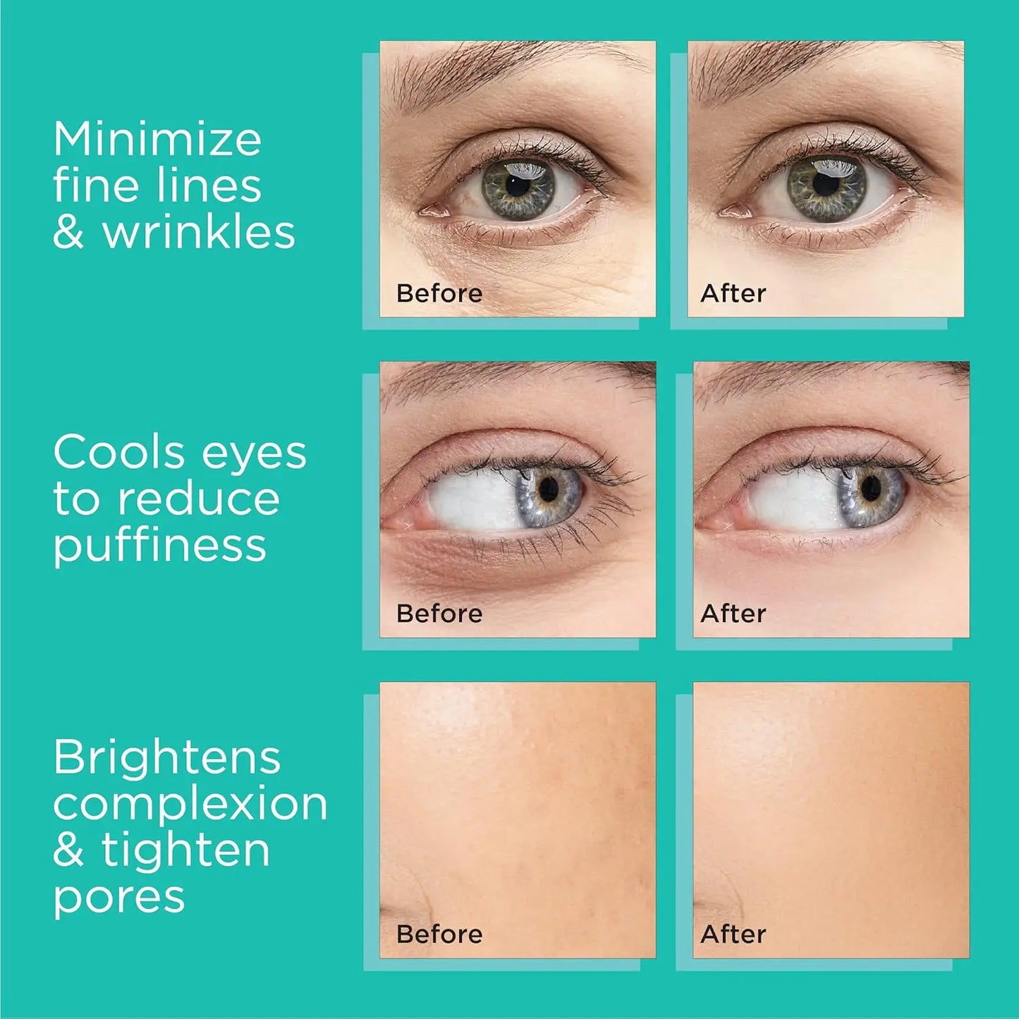 Stainless Ice Globes Facial Cooling Roller