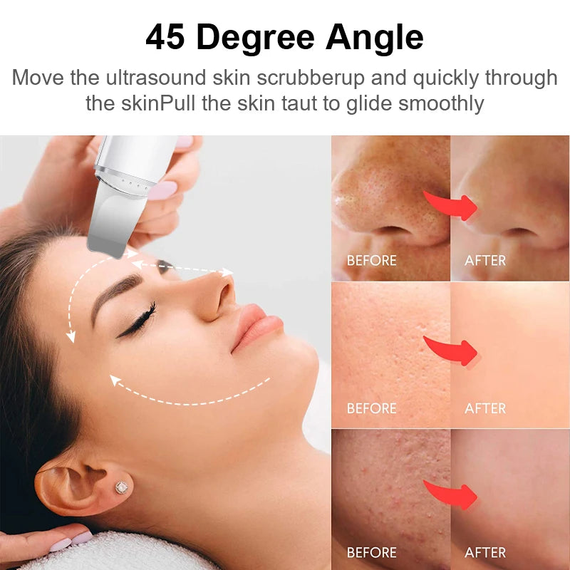 Ultrasonic Skin Scrubber Vibration Facial Lifting skin care