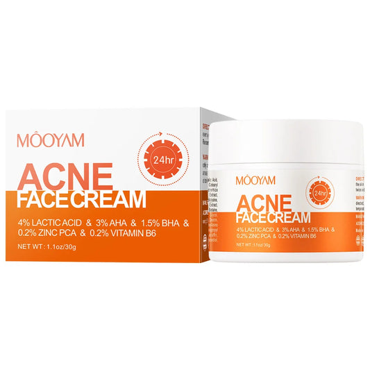 Acne Treatment Cream Oil Control