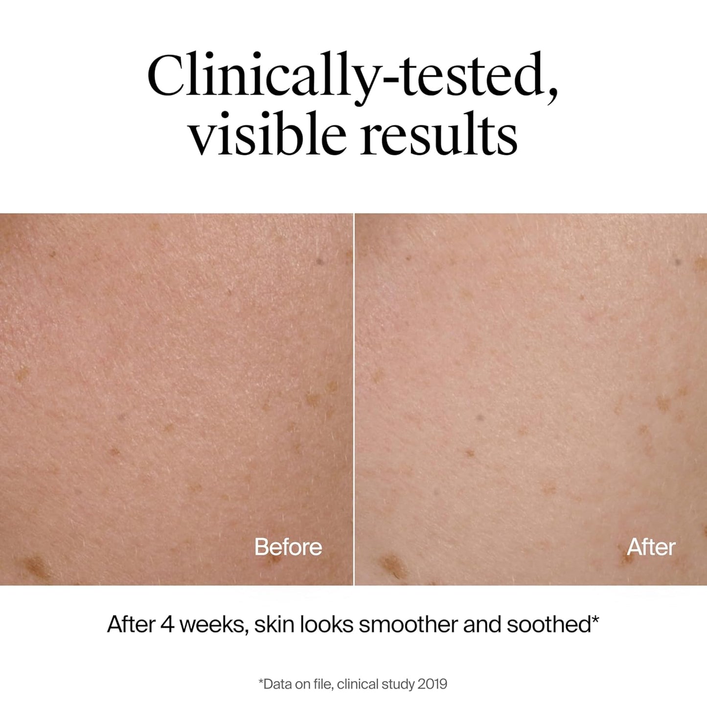 Hydro Boost Face Wash Soothing Milk Cleanser, Fragrance Free Hydrating Facial Cleanser with Hyaluronic Acid, Sensitive Skin Face Wash & Makeup Remover, 7.8 Fl Oz