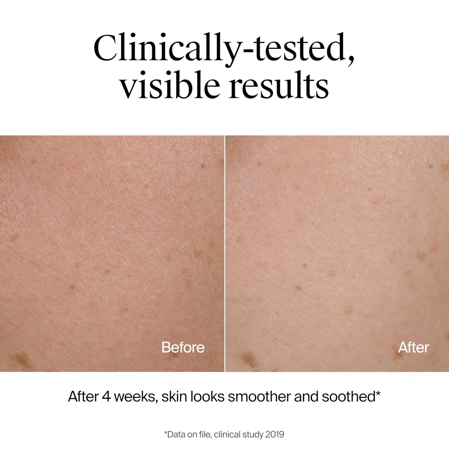 Hydro Boost Face Wash Soothing Milk Cleanser, Fragrance Free Hydrating Facial Cleanser with Hyaluronic Acid, Sensitive Skin Face Wash & Makeup Remover, 7.8 Fl Oz